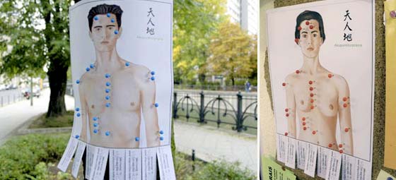 Acupuncture Guerrilla Marketing Pin Posters
